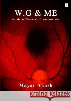 W.G & ME, Surviving Wegener's Granulomatosis: Wegener's Granulomatosis Akash, Mayar 9781910499320 Ma Publisher - książka