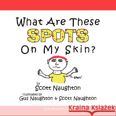 What Are These Spots On My Skin? Scott Naughton 9781425906016 Authorhouse - książka