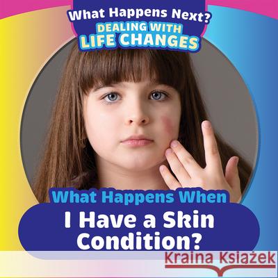 What Happens When I Have a Skin Condition? Emiliya King 9781499452648 PowerKids Press - książka