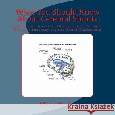 What You Should Know About Cerebral Shunts: Definition, Infection, Obstructions, Common Diseases that may require Shunt Placements Wesley, Misty Lynn 9781512085686 Createspace - książka