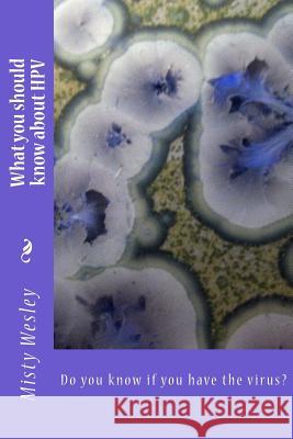 What you should know about HPV: Do you know if you have the virus? Misty Lynn Wesley 9781503369597 Createspace Independent Publishing Platform - książka