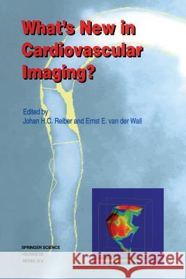 What's New in Cardiovascular Imaging? Johan H. C. Reiber Ernst E. Van Der Wall 9789401061544 Springer - książka