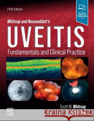 Whitcup and Nussenblatt's Uveitis: Fundamentals and Clinical Practice Scott M. Whitcup H. Nida Sen 9780323480147 Elsevier - książka