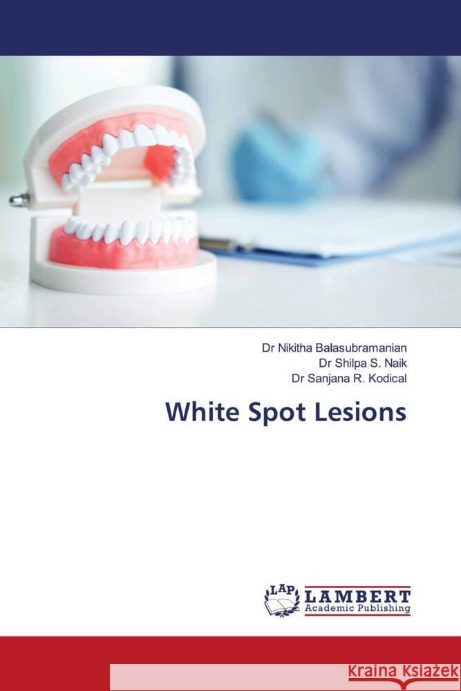 White Spot Lesions Balasubramanian, Dr Nikitha, S. Naik, Dr Shilpa, R. Kodical, Dr Sanjana 9786208010621 LAP Lambert Academic Publishing - książka