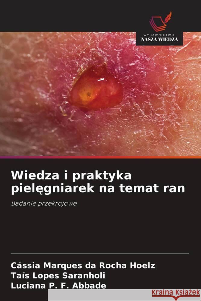 Wiedza i praktyka pielęgniarek na temat ran C?ssia Marques Da Rocha Hoelz Ta?s Lopes Saranholi Luciana P. F. Abbade 9786208536213 Wydawnictwo Nasza Wiedza - książka
