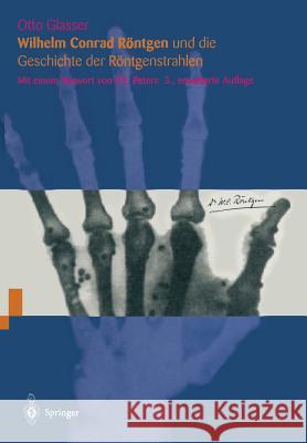 Wilhelm Conrad Röntgen Und Die Geschichte Der Röntgenstrahlen Peters, P. E. 9783642793134 Springer - książka