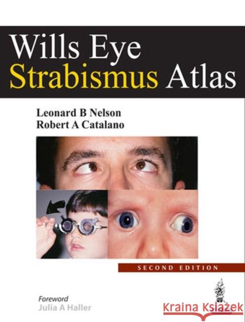 Wills Eye Strabismus Atlas Leonard B. Nelson 9789351521853 Jp Medical Ltd - książka