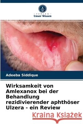 Wirksamkeit von Amlexanox bei der Behandlung rezidivierender aphthöser Ulzera - ein Review Adeeba Siddique 9786203347845 Verlag Unser Wissen - książka