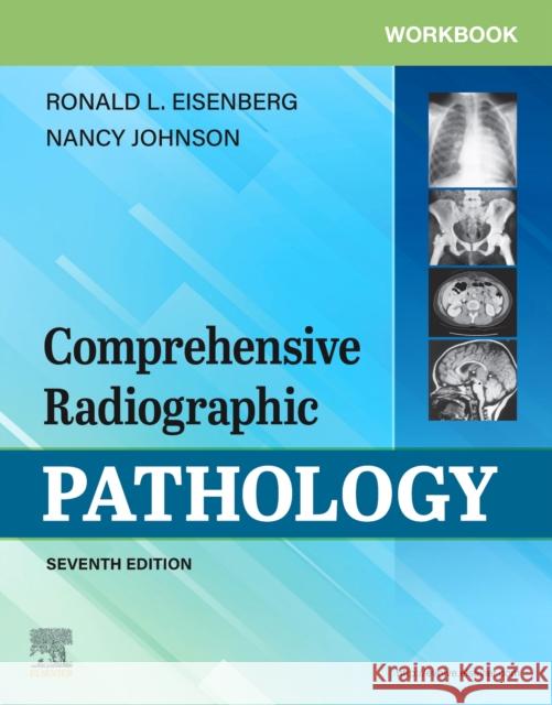 Workbook for Comprehensive Radiographic Pathology Ronald L. Eisenberg Nancy M. Johnson 9780323570879 Elsevier - książka