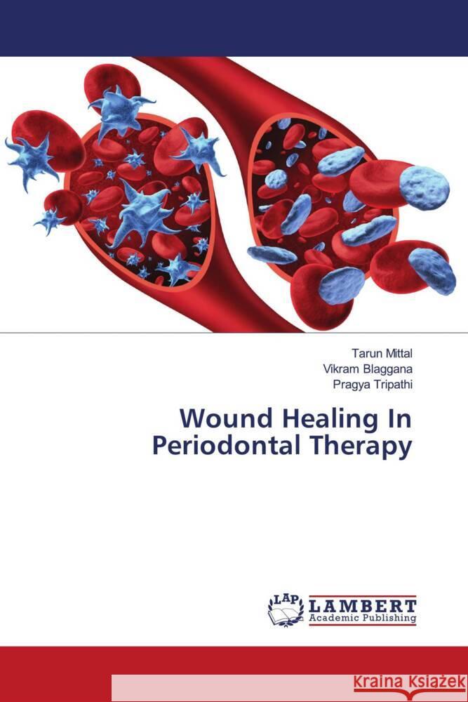 Wound Healing In Periodontal Therapy Mittal, Tarun, Blaggana, Vikram, Tripathi, Pragya 9786204978116 LAP Lambert Academic Publishing - książka