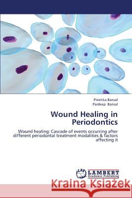 Wound Healing in Periodontics Bansal Preetika 9783659382574 LAP Lambert Academic Publishing - książka