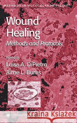 Wound Healing: Methods and Protocols DiPietro, Luisa A. 9780896039995 Humana Press - książka