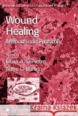 Wound Healing: Methods and Protocols DiPietro, Luisa A. 9781617372964 Springer - książka