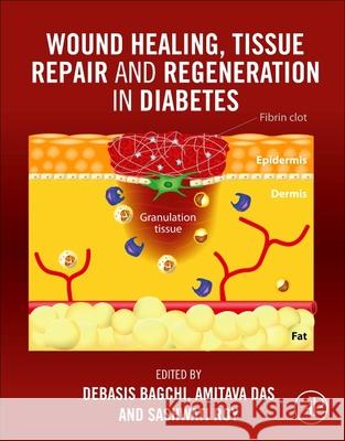 Wound Healing, Tissue Repair and Regeneration in Diabetes Debasis Bagchi Sashwati Roy Amitava Das 9780128164136 Academic Press - książka