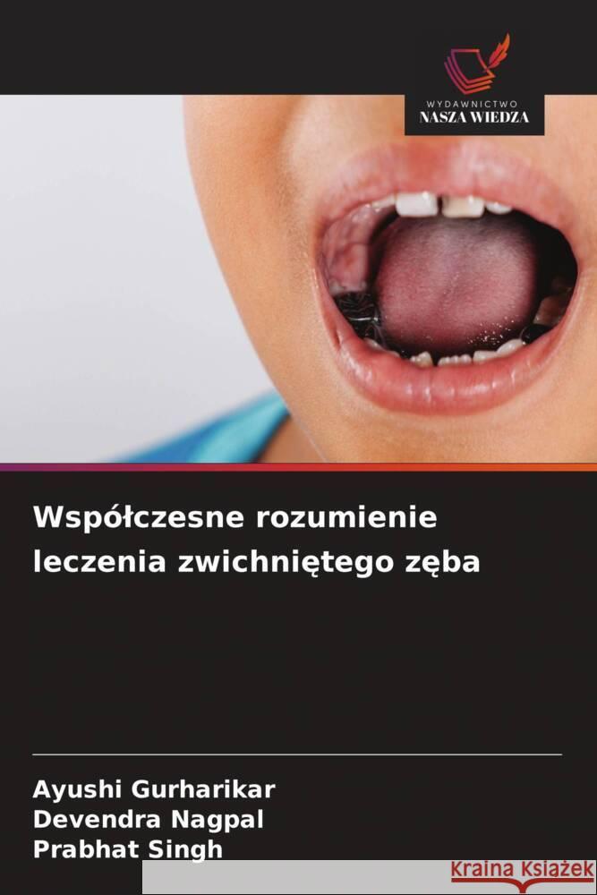 Wspólczesne rozumienie leczenia zwichnietego zeba Gurharikar, Ayushi, Nagpal, Devendra, Singh, Prabhat 9786202741170 Wydawnictwo Nasza Wiedza - książka