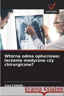 Wtórna odma oplucnowa: leczenie medyczne czy chirurgiczne? Chaari, Zied 9786209304729 Wydawnictwo Nasza Wiedza - książka