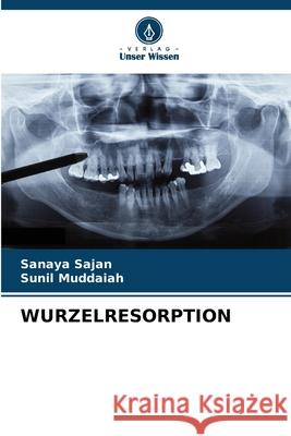 WURZELRESORPTION Sajan, Sanaya, Muddaiah, Sunil 9786202329408 Verlag Unser Wissen - książka