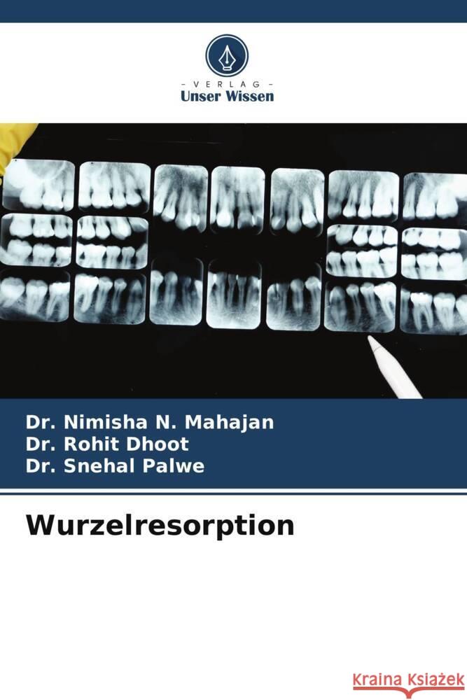 Wurzelresorption Nimisha N. Mahajan Rohit Dhoot Snehal Palwe 9786206669890 Verlag Unser Wissen - książka