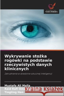 Wykrywanie stożka rogówki na podstawie rzeczywistych danych klinicznych Malla, Mustafa Ali, Al-Nima, Raid Rafi Omar, Han, Tingting 9786630115888 Wydawnictwo Nasza Wiedza - książka