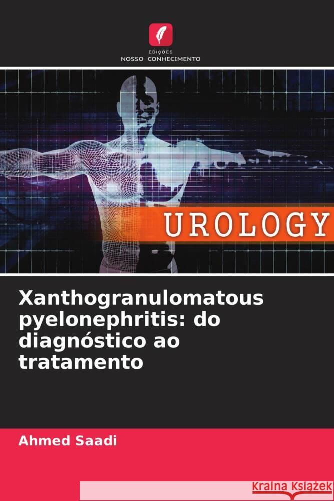 Xanthogranulomatous pyelonephritis: do diagnóstico ao tratamento Saadi, Ahmed 9786204777542 Edições Nosso Conhecimento - książka