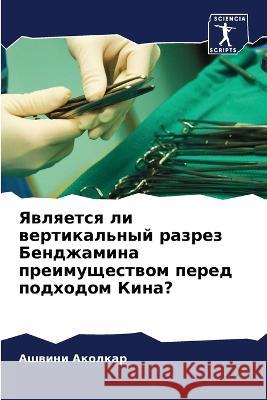 Yawlqetsq li wertikal'nyj razrez Bendzhamina preimuschestwom pered podhodom Kina? Akolkar, Ashwini 9786206125891 Sciencia Scripts - książka