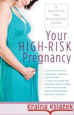 Your High-Risk Pregnancy: A Practical and Supportive Guide Diana Raab 9781630268411 Hunter House Publishers - książka