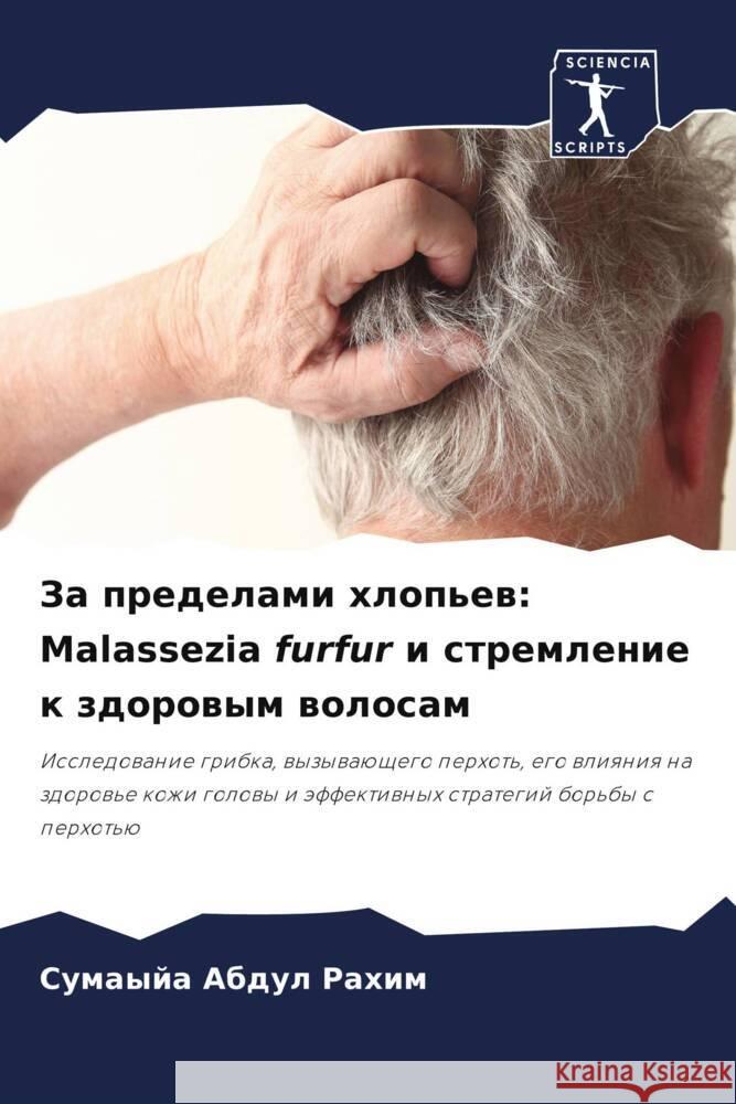 Za predelami hlop'ew: Malassezia furfur i stremlenie k zdorowym wolosam Abdul Rahim, Sumayja 9786208584122 Sciencia Scripts - książka