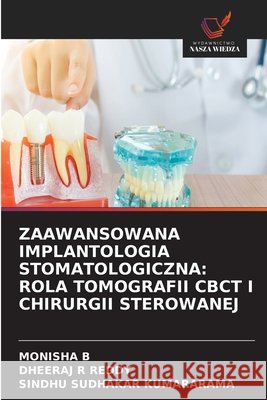 Zaawansowana Implantologia Stomatologiczna: Rola Tomografii Cbct I Chirurgii Sterowanej Monisha B Dheeraj R. Reddy Sindhu Sudhakar Kumararama 9786630218503 Wydawnictwo Nasza Wiedza - książka
