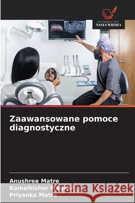 Zaawansowane pomoce diagnostyczne Matre, Anushree, Mankar, Kamalkishor, Matre, Priyanka 9783330824744 Wydawnictwo Nasza Wiedza - książka