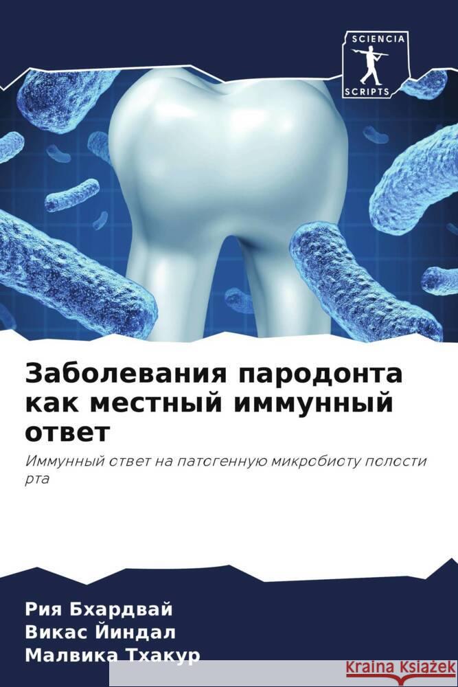 Zabolewaniq parodonta kak mestnyj immunnyj otwet Bhardwaj, Riq, Jindal, Vikas, Thakur, Malwika 9786205446072 Sciencia Scripts - książka
