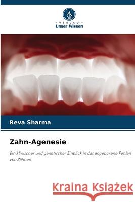 Zahn-Agenesie Sharma, Reva 9786208867997 Verlag Unser Wissen - książka