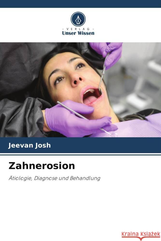Zahnerosion Jeevan Josh 9786207009572 Verlag Unser Wissen - książka