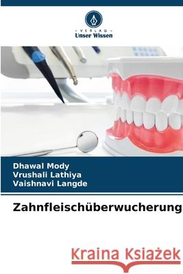 Zahnfleischüberwucherung Mody, Dhawal, Lathiya, Vrushali, LANGDE, VAISHNAVI 9786208739539 Verlag Unser Wissen - książka