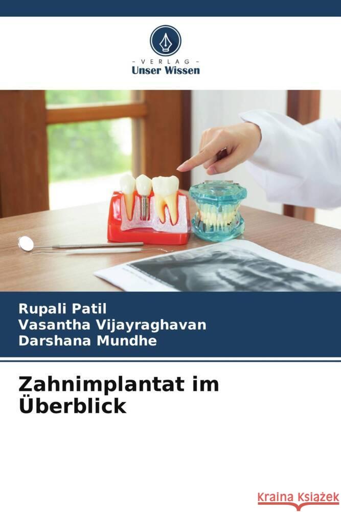 Zahnimplantat im Überblick Patil, Rupali, Vijayraghavan, Vasantha, Mundhe, Darshana 9786205161500 Verlag Unser Wissen - książka