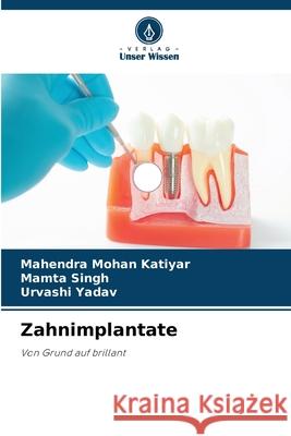 Zahnimplantate KATIYAR, MAHENDRA MOHAN, Singh, Mamta, YADAV, URVASHI 9786209213434 Verlag Unser Wissen - książka
