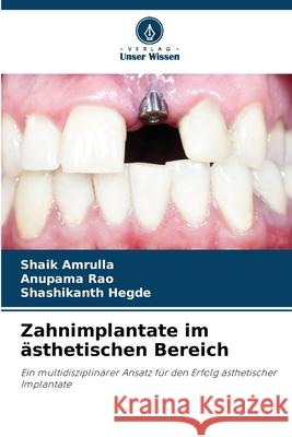 Zahnimplantate im ästhetischen Bereich Amrulla, Shaik, Rao, Anupama, Hegde, Shashikanth 9786209026294 Verlag Unser Wissen - książka