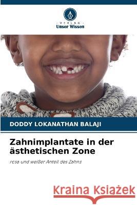 Zahnimplantate in der asthetischen Zone Doddy Lokanathan Balaji   9786205653579 Verlag Unser Wissen - książka