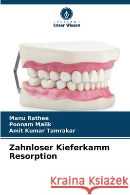 Zahnloser Kieferkamm Resorption Rathee, Manu, Malik, Poonam, Tamrakar, Amit Kumar 9786209221866 Verlag Unser Wissen - książka