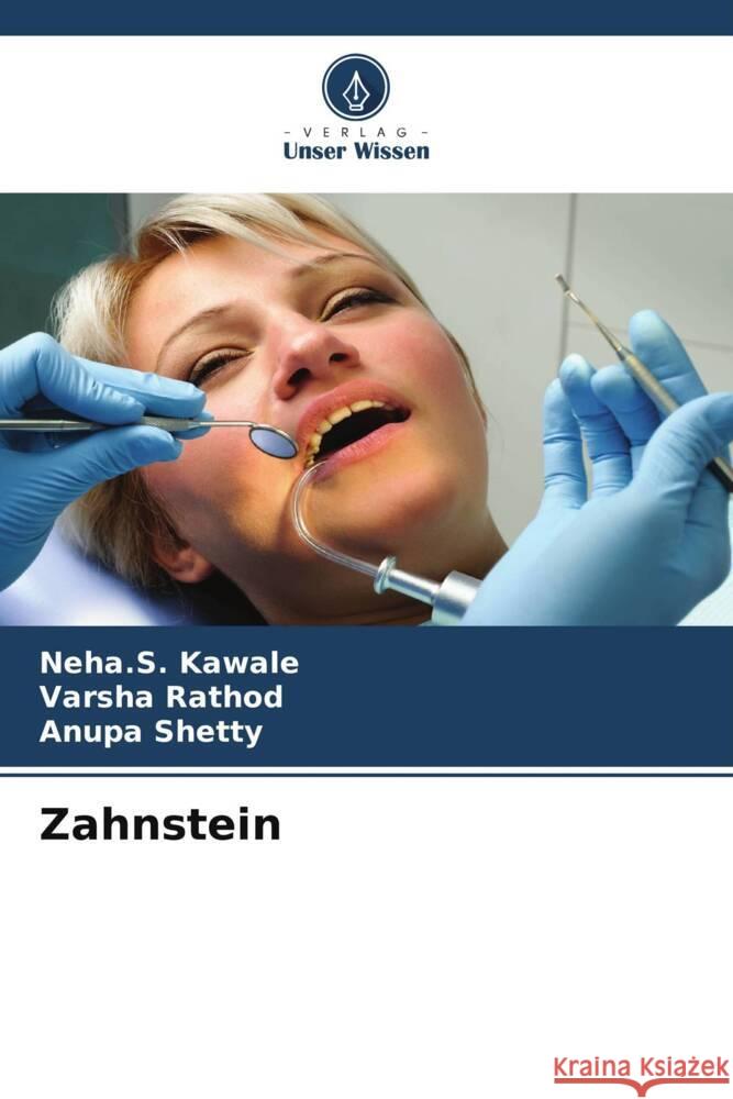 Zahnstein Kawale, Neha.S., Rathod, Varsha, Shetty, Anupa 9786204795164 Verlag Unser Wissen - książka