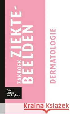 Zakboek Ziektebeelden - Dermatologie Linden, Karin 9789031364688 Bohn Stafleu Van Loghum - książka