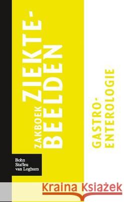 Zakboek Ziektebeelden Gastro-Enterologie Linden, Karin 9789031364596 Bohn Stafleu Van Loghum - książka
