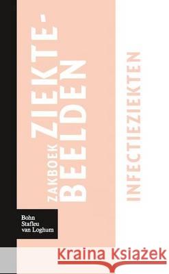 Zakboek Ziektebeelden Infectieziekten Linden, Karin 9789031364671 Bohn Stafleu Van Loghum - książka