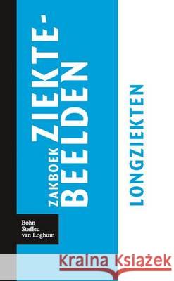 Zakboek Ziektebeelden Longziekten Linden, Karin 9789031364602 Bohn Stafleu Van Loghum - książka