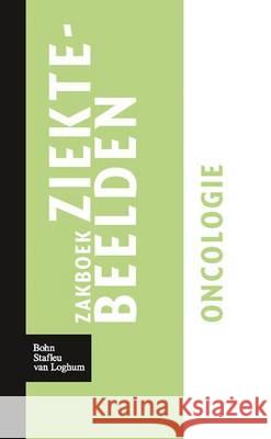 Zakboek Ziektebeelden Oncologie Linden, Karin 9789031364909 Bohn Stafleu Van Loghum - książka