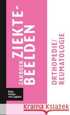 Zakboek Ziektebeelden Orthopedie / Reumatologie Linden, Karin 9789031364640 Bohn Stafleu Van Loghum - książka