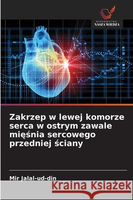 Zakrzep w lewej komorze serca w ostrym zawale miesnia sercowego przedniej sciany Jalal-ud-din, Mir 9786136286310 Wydawnictwo Nasza Wiedza - książka