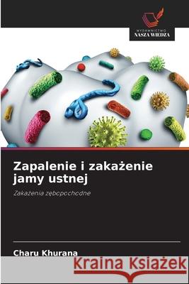 Zapalenie i zakazenie jamy ustnej Khurana, Charu 9786208712945 Wydawnictwo Nasza Wiedza - książka