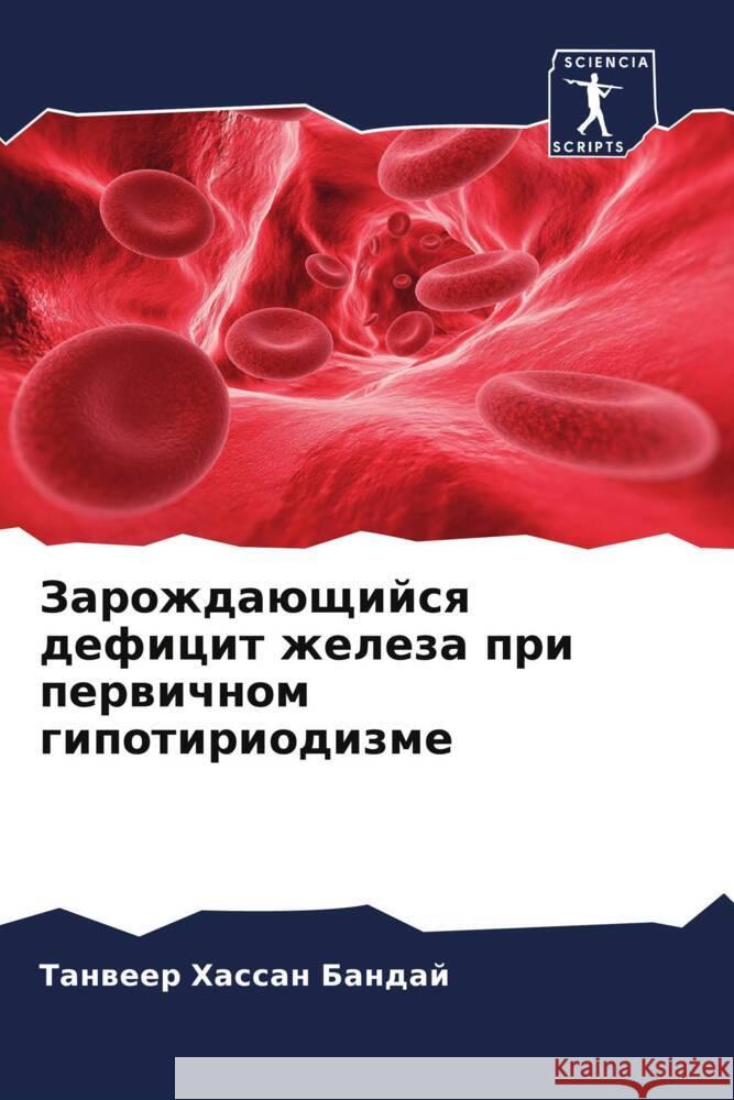 Zarozhdaüschijsq deficit zheleza pri perwichnom gipotiriodizme Bandaj, Tanweer Hassan 9786205115183 Sciencia Scripts - książka