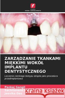 ZARZADZANIE TKANKAMI MI KKIMI WOKÓL IMPLANTU DENTYSTYCZNEGO Gangil, Pankaj, Arora, Sachitanand, Das, Jeevika 9786208471187 Edições Nosso Conhecimento - książka