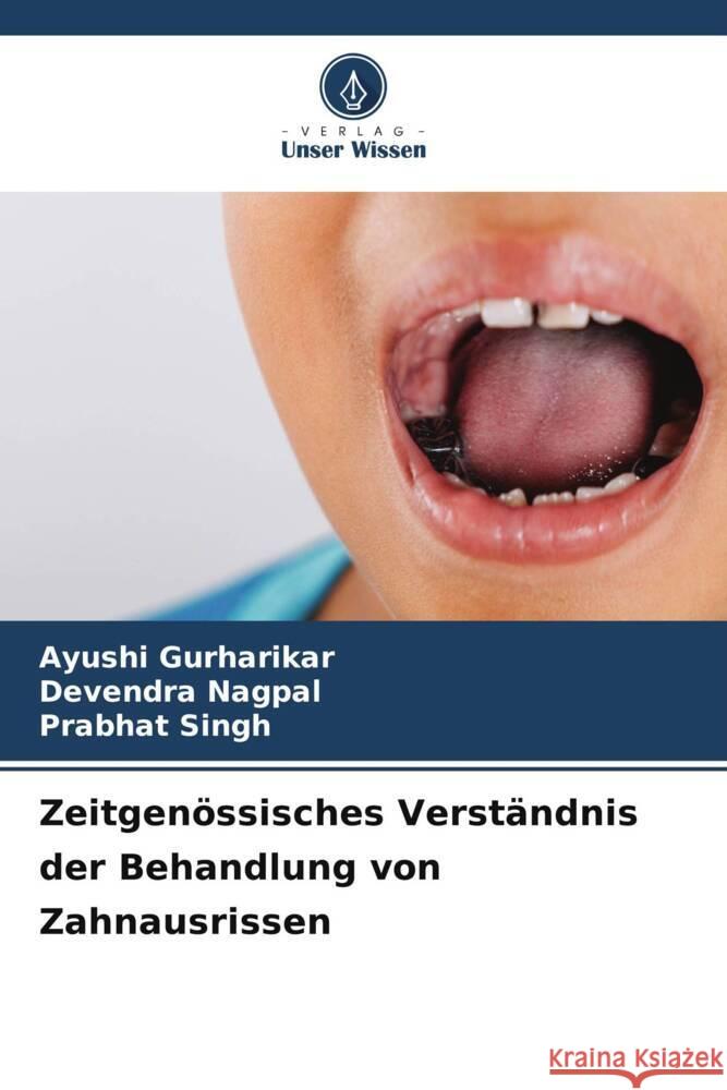Zeitgenössisches Verständnis der Behandlung von Zahnausrissen Gurharikar, Ayushi, Nagpal, Devendra, Singh, Prabhat 9786202741149 Verlag Unser Wissen - książka